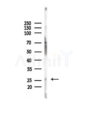 RBPMS Antibody - Western blot analysis of lysates from Hela cells(heat-shock,45min treatment), using RBPMS Antibody at 1/1000 dilution.