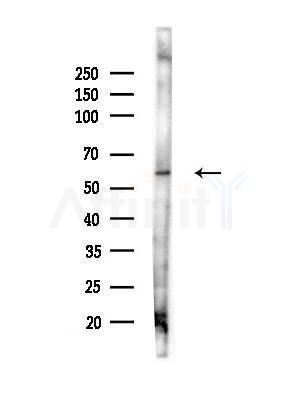 Syntrophin alpha 1 Antibody - Western blot analysis of lysates from Mouse liver, using Syntrophin alpha 1 Antibody at 1/1000 dilution.