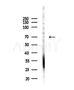 TDP1 Antibody - Western blot analysis of lysates from HUVEC cells(UV,30min treatment), using TDP1 Antibody at 1/1000 dilution.
