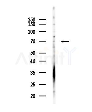 TDP1 Antibody - Western blot analysis of lysates from Hela cells(starvation,24h treatment), using TDP1 Antibody at 1/1000 dilution.