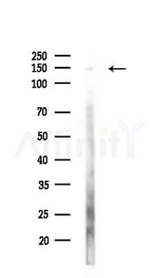 KDM6A / UTX Antibody - Western blot analysis of lysates from HepG2 cells(LPS,4h treatment), using KDM6A / UTX Antibody at 1/1000 dilution.