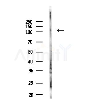 KDM4B / JMJD2B Antibody - Western blot analysis of lysates from Rat testis, using KDM4B / JMJD2B Antibody at 1/1000 dilution.