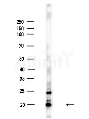 SCXA Antibody - Western blot analysis of lysates from A375 cells(heat-shock,45min treatment), using SCXA Antibody at 1/1000 dilution.