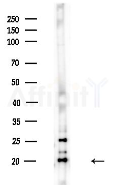 SCXA Antibody - Western blot analysis of lysates from HUVEC cells(UV,30min treatment), using SCXA Antibody at 1/1000 dilution.