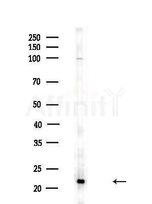 SCXA Antibody - Western blot analysis of lysates from Rat lung, using SCXA Antibody at 1/1000 dilution.