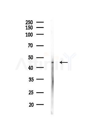 P2X3 Antibody - Western blot analysis of lysates from COLO205 cells(heat-shock,45min treatment), using P2X3 Antibody at 1/1000 dilution.