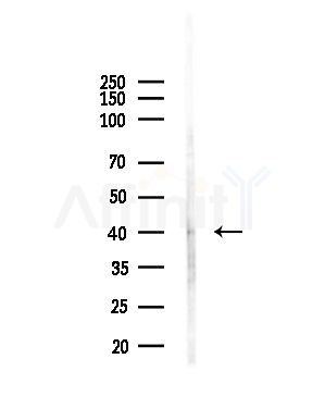 macroH2A.1 Antibody - Western blot analysis of lysates from HUVEC cells(UV,30min treatment), using macroH2A.