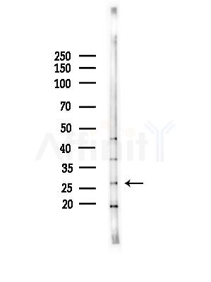 Kallikrein 9 Antibody - Western blot analysis of lysates from COLO205 cells(heat-shock,45min treatment), using Kallikrein 9 Antibody at 1/1000 dilution.