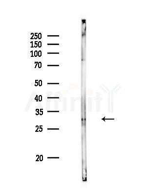 BAFF Antibody - Western blot analysis of lysates from Rat liver, using BAFF Antibody at 1/1000 dilution.