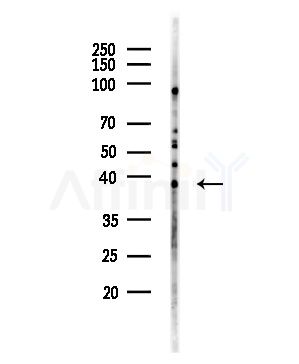 CXCL16 Antibody - Western blot analysis of lysates from HUVEC cells(UV,30min treatment), using CXCL16 Antibody at 1/1000 dilution.