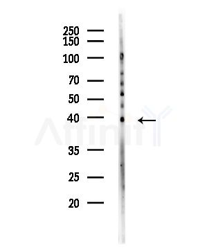 CXCL16 Antibody - Western blot analysis of lysates from Hela cells(starvation,24h treatment), using CXCL16 Antibody at 1/1000 dilution.