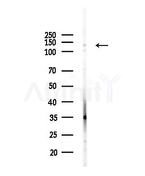 SMC2 Antibody - Western blot analysis of lysates from HUVEC cells(UV,30min treatment), using SMC2 Antibody at 1/1000 dilution.