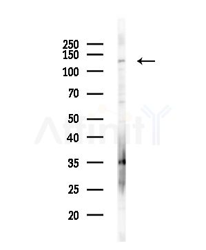 SMC2 Antibody - Western blot analysis of lysates from Hela cells(starvation,24h treatment), using SMC2 Antibody at 1/1000 dilution.