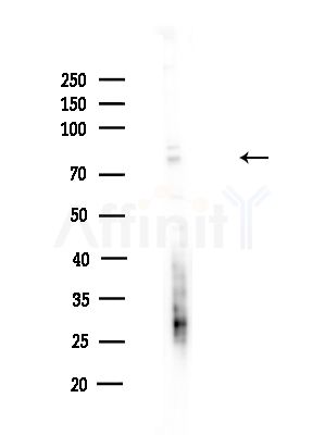 GOLPH4 Antibody - Western blot analysis of lysates from HUVEC cells(UV,30min treatment), using GOLPH4 Antibody at 1/1000 dilution.