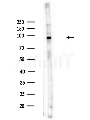 DPP9 - Catalytic domain Antibody - Western blot analysis of lysates from HUVEC cells(UV,30min treatment), using DPP9 - Catalytic domain Antibody at 1/1000 dilution.