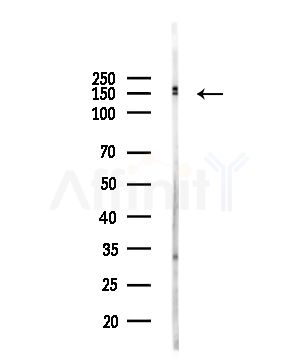 KIF17 Antibody - Western blot analysis of lysates from HUVEC cells(UV,30min treatment), using KIF17 Antibody at 1/1000 dilution.