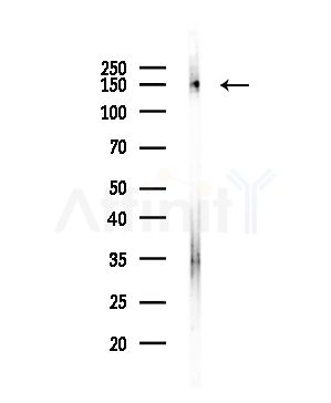 KIF17 Antibody - Western blot analysis of lysates from Hela cells(starvation,24h treatment), using KIF17 Antibody at 1/1000 dilution.