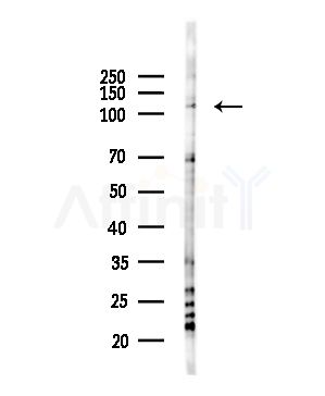 KDM4A Antibody - Western blot analysis of lysates from HUVEC cells(UV,30min treatment), using KDM4A Antibody at 1/1000 dilution.