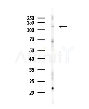 KDM4A Antibody - Western blot analysis of lysates from Hela cells(starvation,24h treatment), using KDM4A Antibody at 1/1000 dilution.