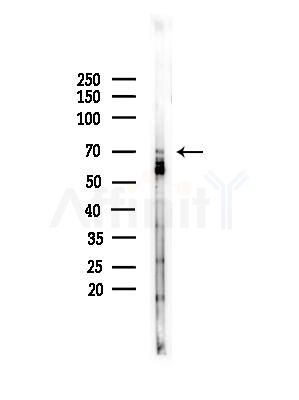 PICALM Antibody - Western blot analysis of lysates from COLO205 cells(heat-shock,45min treatment), using PICALM Antibody at 1/1000 dilution.