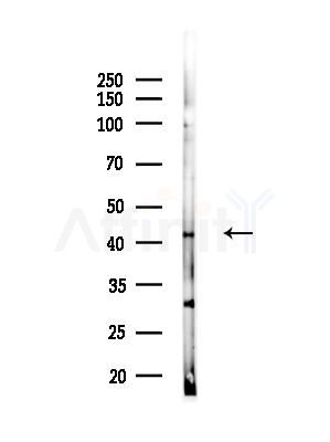 KLF15 Antibody - Western blot analysis of lysates from COLO205 cells(heat-shock,45min treatment), using KLF15 Antibody at 1/1000 dilution.