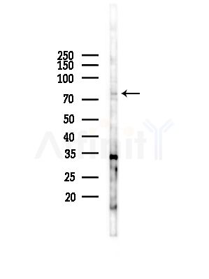 KCNC3 Antibody - Western blot analysis of lysates from COLO205 cells(UV,30min treatment), using KCNC3 Antibody at 1/1000 dilution.