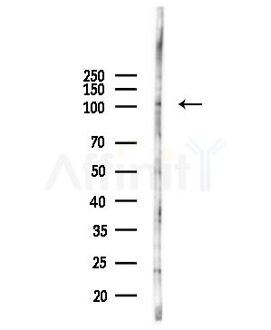 MSH4 Antibody - Western blot analysis of lysates from HUVEC cells(UV,30min treatment), using MSH4 Antibody at 1/1000 dilution.