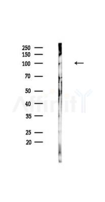 MSH4 Antibody - Western blot analysis of lysates from HUVEC cells(UV,30min treatment), using MSH4 Antibody at 1/1000 dilution.