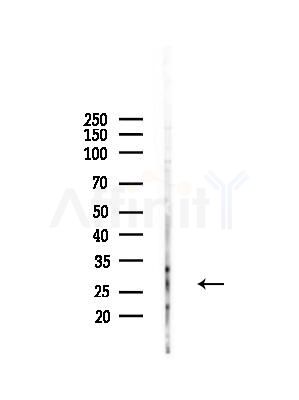 Endomucin Antibody - Western blot analysis of lysates from RAW264.