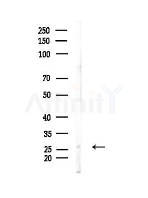 Endomucin Antibody - Western blot analysis of lysates from Mouse muscle, using Endomucin Antibody at 1/1000 dilution.