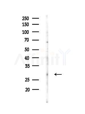 Endomucin Antibody - Western blot analysis of lysates from MDA-MB-231 cells(heat-shock, 45min treatment), using Endomucin Antibody at 1/1000 dilution.