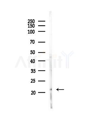 Endostatin Antibody - Western blot analysis of lysates from PC12 cells(heat-shock,45min treatment), using Endostatin Antibody at 1/1000 dilution.