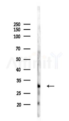 DNase II Antibody - Western blot analysis of lysates from HepG2 cells(LPS,4h treatment), using DNase II Antibody at 1/1000 dilution.