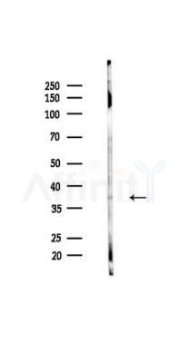 DFFB Antibody - Western blot analysis of lysates from HUVEC cells(UV,30min treatment), using DFFB Antibody at 1/1000 dilution.