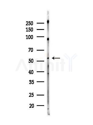 DGAT1 Antibody - Western blot analysis of lysates from Hela cells(heat-shock,45min treatment), using DGAT1 Antibody at 1/1000 dilution.