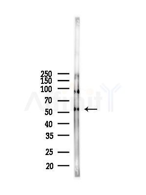 DGAT1 Antibody - Western blot analysis of lysates from Mouse kidney, using DGAT1 Antibody at 1/1000 dilution.