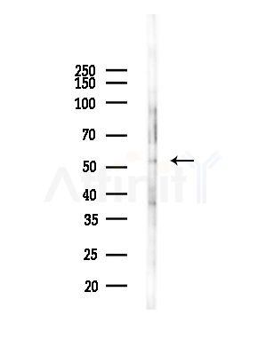 Activin Receptor Type IA Antibody - Western blot analysis of lysates from COLO205 cells(heat-shock,45min treatment), using Activin Receptor Type IA Antibody at 1/1000 dilution.