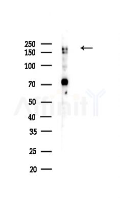 GW182 Antibody - Western blot analysis of lysates from COLO205 cells(UV,30min treatment), using GW182 Antibody at 1/1000 dilution.