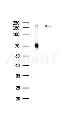 GW182 Antibody - Western blot analysis of lysates from HepG2 cells(LPS,4h treatment), using GW182 Antibody at 1/1000 dilution.