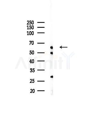 IL22 Receptor Alpha Antibody - Western blot analysis of lysates from Hela cells(UV,30 min treatment), using IL22 Receptor Alpha Antibody at 1/1000 dilution.