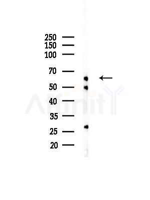IL22 Receptor Alpha Antibody - Western blot analysis of lysates from Hela cells(UV,30 min treatment), using IL22 Receptor Alpha Antibody at 1/1000 dilution.