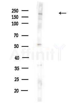 Spt6 Antibody - Western blot analysis of lysates from HUVEC cells(UV,30min treatment), using Spt6 Antibody at 1/1000 dilution.