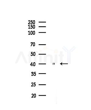 Synaptotagmin 5 Antibody - Western blot analysis of lysates from HUVEC cells(UV,30min treatment), using Synaptotagmin Antibody at 1/1000 dilution.