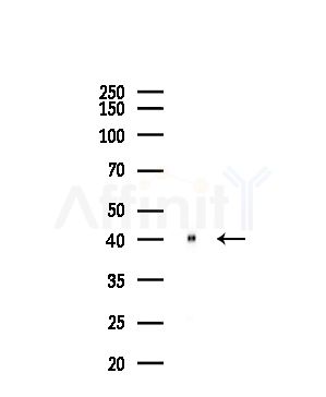 Synaptotagmin 5 Antibody - Western blot analysis of lysates from Hela cells(starvation,24h treatment), using Synaptotagmin Antibody at 1/1000 dilution.