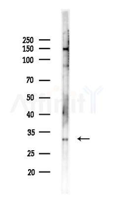 CD1a Antibody - Western blot analysis of lysates from HepG2 cells(LPS,4h treatment), using CD1a Antibody at 1/1000 dilution.