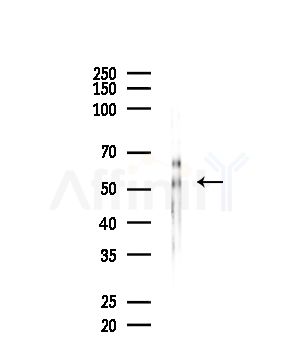 SEPT4 Antibody - Western blot analysis of lysates from Mouse brain, using SEPT4 Antibody at 1/1000 dilution.