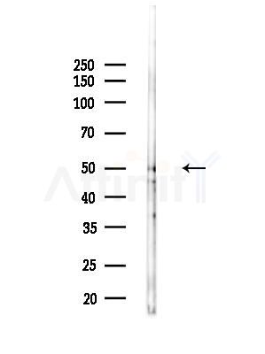 PP2C beta Antibody - Western blot analysis of lysates from Hela cells(UV,30 min treatment), using PP2C alpha Antibody at 1/1000 dilution.