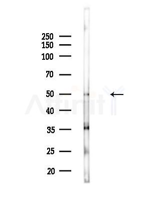 PP2C beta Antibody - Western blot analysis of lysates from COLO205 cells(heat-shock,45min treatment), using PP2C alpha Antibody at 1/1000 dilution.