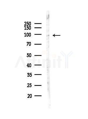 TRPC3 Antibody - Western blot analysis of lysates from MDA-MB-231 cells(heat-shock,45min treatment), using TRPC3 Antibody at 1/1000 dilution.
