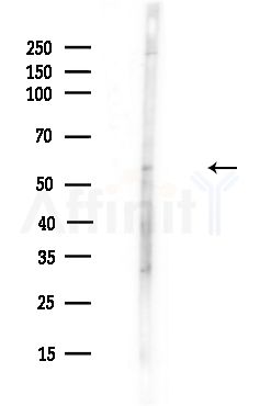 EBF2 Antibody - Western blot analysis of lysates from A375 cells(heat-shock,45min treatment), using EBF2 Antibody at 1/1000 dilution.
